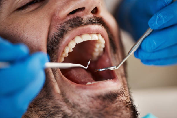 Best After-Hours Emergency Dentist in Auburn, CA