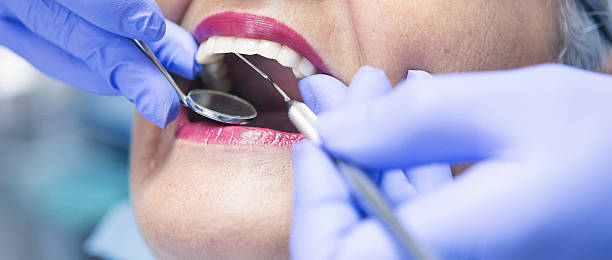 Best After-Hours Emergency Dentist in Auburn, CA